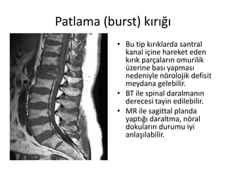 Patlama (burst) kırığı
           • Bu tip kırıklarda santral
             kanal içine hareket eden
             kırık parçaların omurilik
             üzerine bası yapması
             nedeniyle nörolojik defisit
             meydana gelebilir.
           • BT ile spinal daralmanın
             derecesi tayin edilebilir.
           • MR ile sagittal planda
             yaptığı daraltma, nöral
             dokuların durumu iyi
             anlaşılabilir.
 