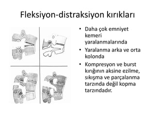 Fleksiyon-distraksiyon kırıkları
                • Daha çok emniyet
                  kemeri
                  yaralanmalarında
                • Yaralanma arka ve orta
                  kolonda
                • Kompresyon ve burst
                  kırığının aksine ezilme,
                  sıkışma ve parçalanma
                  tarzında değil kopma
                  tarzındadır.
 