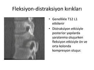 Fleksiyon-distraksiyon kırıkları
                • Genellikle T12 L1
                  etkilenir
                • Distraksiyon etkisiyle
                  posterior yapılarda
                  yaralanma oluşurken
                  fleksiyon etkisiyle ön ve
                  orta kolonda
                  kompresyon oluşur.
 