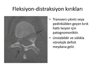 Fleksiyon-distraksiyon kırıkları
                • Transvers çıkıntı veya
                  pedinkülden geçen kırık
                  hattı lezyon için
                  patognomoniktir.
                • Unstabildir ve sıklıkla
                  nörolojik defisit
                  meydana gelir.
 