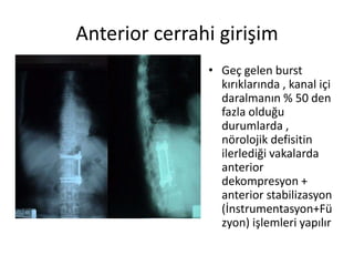 Anterior cerrahi girişim
               • Geç gelen burst
                 kırıklarında , kanal içi
                 daralmanın % 50 den
                 fazla olduğu
                 durumlarda ,
                 nörolojik defisitin
                 ilerlediği vakalarda
                 anterior
                 dekompresyon +
                 anterior stabilizasyon
                 (İnstrumentasyon+Fü
                 zyon) işlemleri yapılır
 