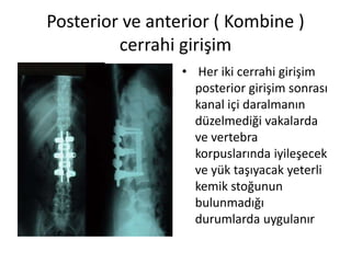 Posterior ve anterior ( Kombine )
         cerrahi girişim
                 • Her iki cerrahi girişim
                   posterior girişim sonrası
                   kanal içi daralmanın
                   düzelmediği vakalarda
                   ve vertebra
                   korpuslarında iyileşecek
                   ve yük taşıyacak yeterli
                   kemik stoğunun
                   bulunmadığı
                   durumlarda uygulanır
 