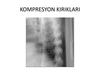 KOMPRESYON KIRIKLARI
 