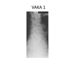 VAKA 1
 