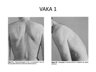 VAKA 1
 