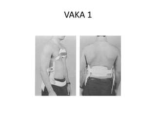 VAKA 1
 