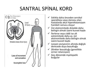 SANTRAL SPİNAL KORD
           Sıklıkla daha önceden servikal
            spondilozu veya stenozu olan
            hastalarda akut hiperekstansiyon
            hareketi sonucu oluşur
           Üst ekstremitede distalde daha
            belirgin olmak üzere kuvvet kaybı
           İlerlerse veya ciddi ise alt
            extremitede daha az, üst
            ekstremitede daha belirgin olmak
            üzere kuvvet kaybı
           Lezyon seviyesinin altında değişik
            derecede duyu bozukluğu
           Sfinkter bozukluğu (genellikle
            üriner retansiyon)
           Geç dönemde myelopatik
            bulgular
 