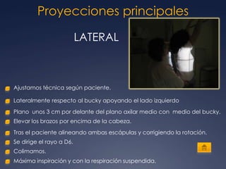 Proyecciones principales

                          LATERAL



Ajustamos técnica según paciente.

Lateralmente respecto al bucky apoyando el lado izquierdo

Plano unos 3 cm por delante del plano axilar medio con medio del bucky.
Elevar los brazos por encima de la cabeza.

Tras el paciente alineando ambas escápulas y corrigiendo la rotación.
Se dirige el rayo a D6.
Colimamos.
Máxima inspiración y con la respiración suspendida.
 
