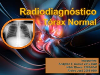 RadiodiagnósticoTórax Normal Integrantes: Andjelko F. Ocasio 2010-0281 Nilda Rivera  2009-0341 Arelys José 2008-0684 