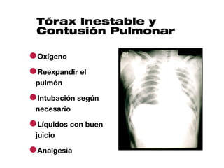 Tórax Inestable y
 Contusión Pulmonar

●Oxígeno
●Reexpandir el
 pulmón

●Intubación según
 necesario

●Líquidos con buen
 juicio

●Analgesia
 