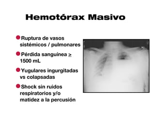 Hemotórax Masivo

●Ruptura de vasos
 sistémicos / pulmonares

●Pérdida sanguínea >
 1500 mL

●Yugulares ingurgitadas
 vs colapsadas

●Shock sin ruidos
 respiratorios y/o
 matidez a la percusión
 