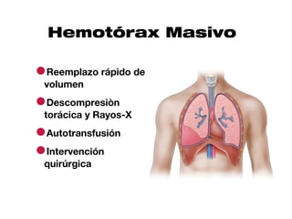 Hemotórax Masivo

●Reemplazo rápido de
 volumen

●Descompresiòn
 torácica y Rayos-X

●Autotransfusión
●Intervención
 quirúrgica
 