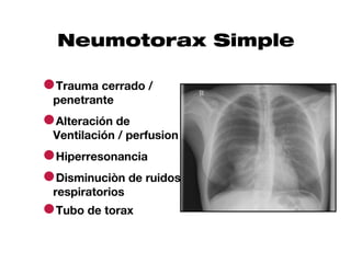 Neumotorax Simple

●Trauma cerrado /
 penetrante

●Alteración de
 Ventilación / perfusion

●Hiperresonancia
●Disminuciòn de ruidos
 respiratorios
●Tubo de torax
 