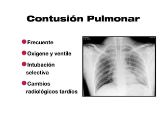 Contusión Pulmonar

●Frecuente
●Oxigene y ventile
●Intubación
 selectiva

●Cambios
 radiológicos tardíos
 