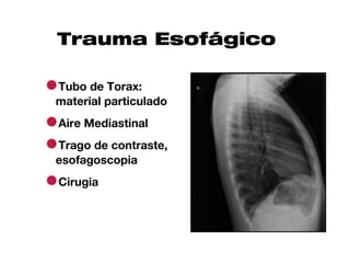 Trauma Esofágico

●Tubo de Torax:
 material particulado

●Aire Mediastinal
●Trago de contraste,
 esofagoscopia

●Cirugia
 