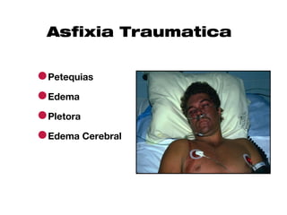 Asfixia Traumatica


●Petequias
●Edema
●Pletora
●Edema Cerebral
 