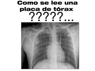 Como se lee una
placa de tórax
  ?????...
      •?
 