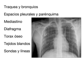 Traquea y bronquios

Espacios pleurales y parénquima

Mediastino

Diafragma

Torax óseo

Tejidos blandos

Sondas y líneas
 