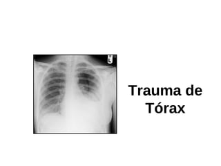 Trauma de
                           Tórax

Initial Assessment and
      Management
 