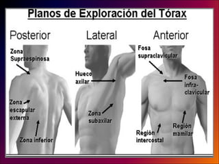 Torax