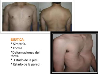 ESTATICA:
* Simetría.
* Forma.
*Deformaciones del
tórax.
* Estado de la piel.
* Estado de la pared.
 