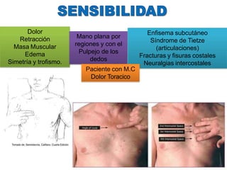 Dolor
Retracción
Masa Muscular
Edema
Simetría y trofismo.
Mano plana por
regiones y con el
Pulpejo de los
dedos
Enfisema subcutáneo
Síndrome de Tietze
(articulaciones)
Fracturas y fisuras costales
Neuralgias intercostales
Paciente con M.C
Dolor Toracico
 