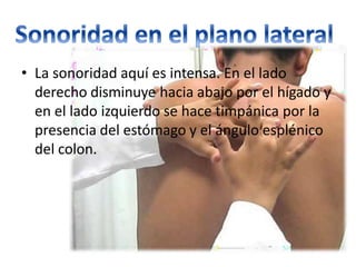 • La sonoridad aquí es intensa. En el lado
derecho disminuye hacia abajo por el hígado y
en el lado izquierdo se hace timpánica por la
presencia del estómago y el ángulo esplénico
del colon.
 