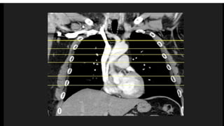 Thoracic Rfa Imaging Comprehensive Thoracic Imaging: Anatomy, Pathologies, and Diagnostic ...