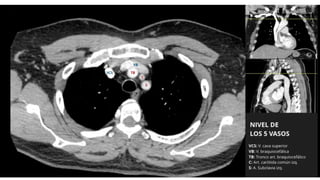 Thoracic Rfa Imaging Comprehensive Thoracic Imaging: Anatomy, Pathologies, and Diagnostic ...