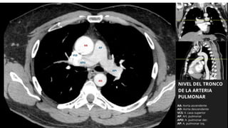 Thoracic Rfa Imaging Comprehensive Thoracic Imaging: Anatomy, Pathologies, and Diagnostic ...