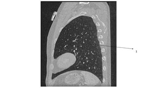 Thoracic Rfa Imaging Comprehensive Thoracic Imaging: Anatomy, Pathologies, and Diagnostic ...