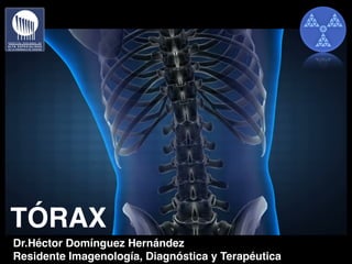 Dr.Héctor Domínguez Hernández
Residente Imagenología, Diagnóstica y Terapéutica
TÓRAX
 