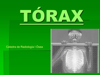 TÓRAX
Cátedra de Radiología I Ósea
 