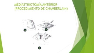 torax anatomia e inciciones quirurgicas .pptx