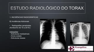 1- INCIDÊNCIAS RADIOGRÁFICAS
B) Incidências Adicionais
• Radiografias penetradas
(Acréscimo de 10 a 20 Kv)
Indicações:
- Estruturas mediastinais
- Arcos costais
- Estruturas ósseas
 
