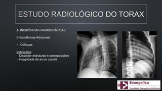 1- INCIDÊNCIAS RADIOGRÁFICAS
B) Incidências Adicionais
• Oblíquas
Indicações:
- Dissociar estruturas e sobreposições
- Integridade de arcos costais
 