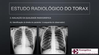 2- AVALIAÇÃO DA QUALIDADE RADIOGRÁFICA
A) Identificação (à direita do paciente / à esquerda do observador)
 