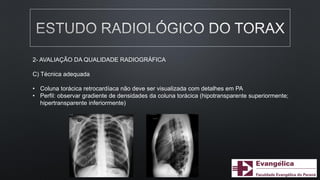 2- AVALIAÇÃO DA QUALIDADE RADIOGRÁFICA
C) Técnica adequada
• Coluna torácica retrocardíaca não deve ser visualizada com detalhes em PA
• Perfil: observar gradiente de densidades da coluna torácica (hipotransparente superiormente;
hipertransparente inferiormente)
 