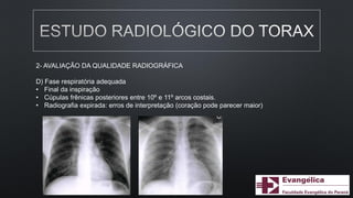 2- AVALIAÇÃO DA QUALIDADE RADIOGRÁFICA
D) Fase respiratória adequada
• Final da inspiração
• Cúpulas frênicas posteriores entre 10º e 11º arcos costais.
• Radiografia expirada: erros de interpretação (coração pode parecer maior)
 