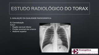 2- AVALIAÇÃO DA QUALIDADE RADIOGRÁFICA
E) Centralização
Incluir:
• Região cervical inferior
• Porção proximal dos úmeros
• Abdome superior
 