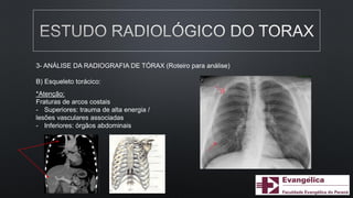 3- ANÁLISE DA RADIOGRAFIA DE TÓRAX (Roteiro para análise)
B) Esqueleto torácico:
*Atenção:
Fraturas de arcos costais
- Superiores: trauma de alta energia /
lesões vasculares associadas
- Inferiores: órgãos abdominais
 