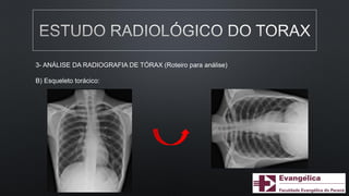 3- ANÁLISE DA RADIOGRAFIA DE TÓRAX (Roteiro para análise)
B) Esqueleto torácico:
 