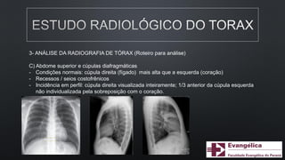 3- ANÁLISE DA RADIOGRAFIA DE TÓRAX (Roteiro para análise)
C) Abdome superior e cúpulas diafragmáticas
- Condições normais: cúpula direita (fígado) mais alta que a esquerda (coração)
- Recessos / seios costofrênicos
- Incidência em perfil: cúpula direita visualizada inteiramente; 1/3 anterior da cúpula esquerda
não individualizada pela sobreposição com o coração.
 