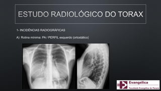 1- INCIDÊNCIAS RADIOGRÁFICAS
A) Rotina mínima: PA / PERFIL esquerdo (ortostático)
 