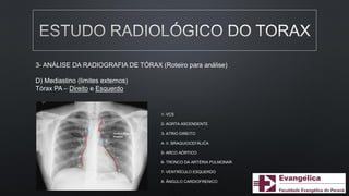 1- VCS
2- AORTA ASCENDENTE
3- ATRIO DIREITO
4- V. BRAQUIOCEFÁLICA
5- ARCO AÓRTICO
6- TRONCO DA ARTÉRIA PULMONAR
7- VENTRÍCULO ESQUERDO
8- ÂNGULO CARDIOFRENICO
3- ANÁLISE DA RADIOGRAFIA DE TÓRAX (Roteiro para análise)
D) Mediastino (limites externos)
Tórax PA – Direito e Esquerdo
 