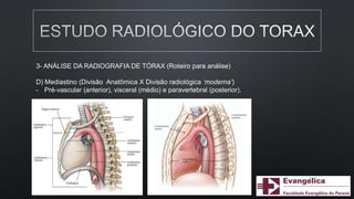3- ANÁLISE DA RADIOGRAFIA DE TÓRAX (Roteiro para análise)
D) Mediastino (Divisão Anatômica X Divisão radiológica ‘moderna’)
- Pré-vascular (anterior), visceral (médio) e paravertebral (posterior).
 