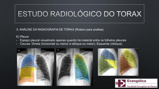 3- ANÁLISE DA RADIOGRAFIA DE TÓRAX (Roteiro para análise)
E) Pleura
- Espaço pleural visualizado apenas quando há material entre os folhetos pleurais
- Cisuras: Direita (horizontal ou menor e oblíqua ou maior); Esquerda (oblíqua).
 