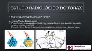4- PADRÕES BÁSICOS EM RADIOLOGIA TORÁCIA
A) Padrão Alveolar (Espaço aéreo)
- Preenchimento do espaço aéreo (alvéolo) por material diferente de ar (exudato, transudato,
sangue, materiais exógenos)
- Poros de Kohn e Canais de Lambert: disseminação entre alvéolos (mas não entre lobos).
 