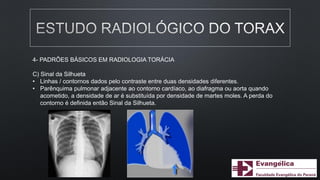 4- PADRÕES BÁSICOS EM RADIOLOGIA TORÁCIA
C) Sinal da Silhueta
• Linhas / contornos dados pelo contraste entre duas densidades diferentes.
• Parênquima pulmonar adjacente ao contorno cardíaco, ao diafragma ou aorta quando
acometido, a densidade de ar é substituída por densidade de martes moles. A perda do
contorno é definida então Sinal da Silhueta.
 