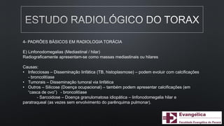 4- PADRÕES BÁSICOS EM RADIOLOGIA TORÁCIA
E) Linfonodomegalias (Mediastinal / hilar)
Radiograficamente apresentam-se como massas mediastinais ou hilares
Causas:
• Infecciosas – Disseminação linfática (TB, histoplasmose) – podem evoluir com calcificações
- broncolitíase
• Tumorais – Disseminação tumoral via linfática
• Outros – Silicose (Doença ocupacional) – também podem apresentar calcificações (em
“casca de ovo”) - broncolitíase
- Sarcoidose – Doença granulomatosa idiopática – linfonodomegalia hilar e
paratraqueal (as vezes sem envolvimento do parênquima pulmonar).
 